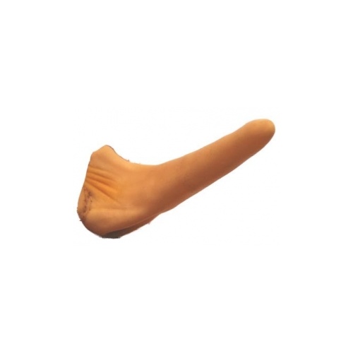 pinocchio nose rhinoplasty